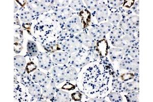IHC-P: AQP2 antibody testing of rat kidney tissue (AQP2 抗体  (AA 245-260))