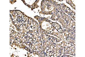 IHC analysis of ATP1B1 using anti-ATP1B1 antibody (ABIN7602014).