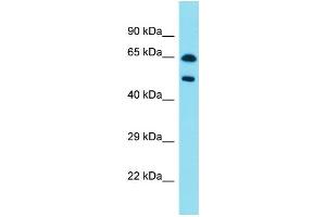 Host:  Rabbit  Target Name:  PAX8  Sample Type:  Pancreas Tumor lysates  Antibody Dilution:  1. (PAX8 抗体  (C-Term))