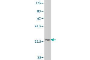 Western Blot detection against Immunogen (37. (HIPK1 抗体  (AA 330-430))
