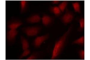 Image no. 1 for anti-GATA Binding Protein 1 (Globin Transcription Factor 1) (GATA1) (pSer310) antibody (ABIN196686) (GATA1 抗体  (pSer310))