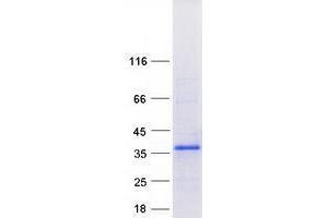 Western Blotting (WB) image for Zinc Finger, AN1-Type Domain 2B (ZFAND2B) protein (Myc-DYKDDDDK Tag) (ABIN2735848)