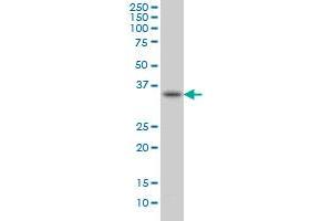 Western Blotting (WB) image for anti-Sprouty Homolog 1, Antagonist of FGF Signaling (SPRY1) (AA 1-110) antibody (ABIN564437)