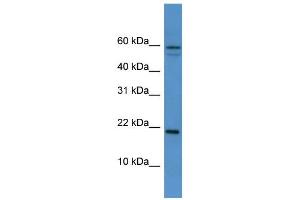 WB Suggested Anti-Hspb7 Antibody Titration:  0. (HSPB7 抗体  (Middle Region))