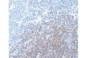 Immunohistochemistry (IHC) image for anti-CD28 (CD28) (AA 19-140) antibody (ABIN7448899) (Recombinant CD28 抗体  (AA 19-140))
