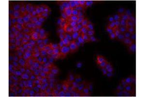 Immunofluorescence (IF) image for anti-Integrin beta 1 (ITGB1) antibody (ABIN2664519) (ITGB1 抗体)