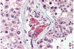 Anti-NEK9 antibody  ABIN1049094 IHC staining of human testis. (NEK9 抗体)