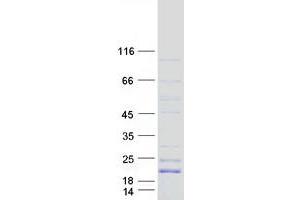 Western Blotting (WB) image for Glycoprotein IX (Platelet) (GP9) protein (Myc-DYKDDDDK Tag) (ABIN2713708)