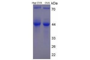 Image no. 1 for Hydroxyproline (Hyp) protein (Ovalbumin) (ABIN1880129) (Hydroxyproline Protein (Hyp) (Ovalbumin))