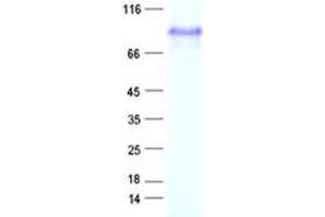 Western Blotting (WB) image for Zinc Finger and BTB Domain Containing 43 (ZBTB43) protein (His tag) (ABIN2712402)