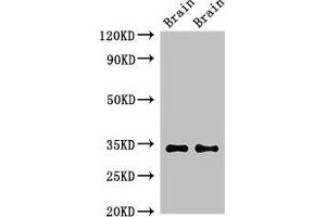 Western Blot Positive WB detected in: Mouse brain tissue, Rat brain tissue All lanes: NPY6R antibody at 2. (NPY6R 抗体  (AA 1-39))