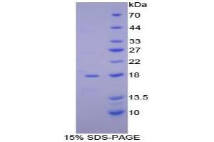 SDS-PAGE analysis of Human aHSP Protein. (aHSP 蛋白)