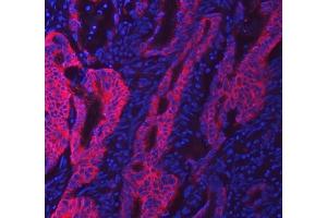 IF analysis of SWAP70 using anti-SWAP70 antibody (ABIN7600201). (SWAP70 抗体  (AA 161-292))