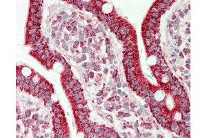Immunohistochemistry (IHC) image for anti-ATP Synthase, H+ Transporting, Mitochondrial F1 Complex, alpha Subunit 1, Cardiac Muscle (ATP5A1) (AA 83-94) antibody (ABIN2617320)