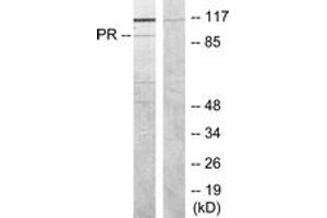 Western blot analysis of extracts from COS7 cells, treated with EGF, using Progesterone Receptor (Ab-190) Antibody. (Progesterone Receptor 抗体  (AA 161-210))