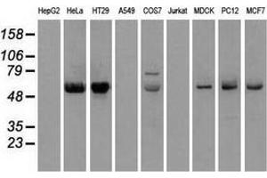 Western blot analysis of extracts (35 µg) from 9 different cell lines by using anti-CHEK2 monoclonal antibody. (CHEK2 抗体)