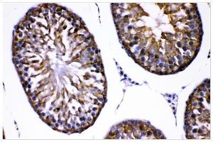 IHC analysis of AMHR2 using anti-AMHR2 antibody (ABIN4886456).