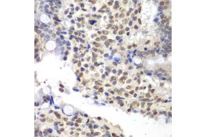 Immunohistochemistry of paraffin-embedded rat Intestine using U2 antibody (ABIN6130748, ABIN6149754, ABIN6214722 and ABIN6214724) at dilution of 1:200 (40x lens). (U2AF1 抗体  (AA 1-240))