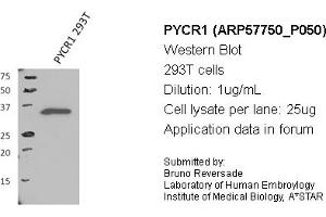 Image no. 1 for anti-Pyrroline-5-Carboxylate Reductase 1 (PYCR1) (Middle Region) antibody (ABIN2787369) (PYCR1 抗体  (Middle Region))