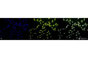 Immunocytochemistry/Immunofluorescence analysis using Rabbit Anti-Phosphothreonine Polyclonal Antibody . (Phosphothreonine 抗体  (FITC))