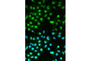 Immunofluorescence analysis of HeLa cell using PPP3CA antibody. (PPP3CA 抗体  (AA 1-511))