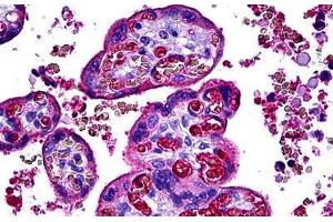 Human Placenta: Formalin-Fixed, Paraffin-Embedded (FFPE) (Complement C3c 抗体)
