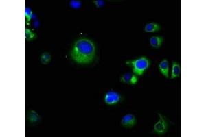 Immunofluorescence staining of MCF-7 cells with ABIN7164878 at 1:66, counter-stained with DAPI. (PRSS8 抗体  (AA 185-319))