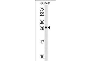 Western blot analysis in Jurkat cell line lysates (35ug/lane). (ANP32C 抗体  (AA 130-158))