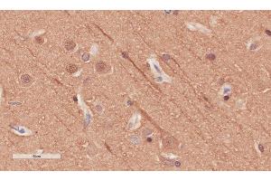Immunohistochemical staining of human cerebral cortex tissue using anti-Alpha Tubulin antibody. (Recombinant alpha Tubulin 抗体)