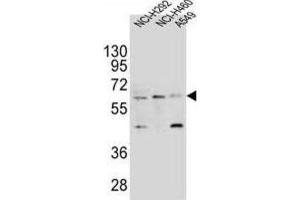 Western Blotting (WB) image for anti-Leukocyte Immunoglobulin-Like Receptor, Subfamily A (With TM Domain), Member 2 (LILRA2) antibody (ABIN2995659) (LILRA2 抗体)