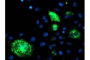 Anti-DHFRL1 mouse monoclonal antibody (ABIN2454838) immunofluorescent staining of COS7 cells transiently transfected by pCMV6-ENTRY DHFRL1 (RC208452). (DHFRL1 抗体  (AA 4-185))