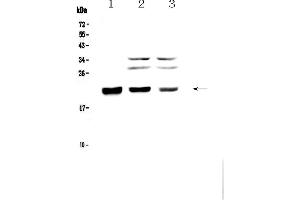 Western blot analysis of CBFb using anti-CBFb antibody . (CBFB 抗体  (AA 1-182))