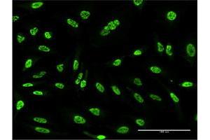 Immunofluorescence of monoclonal antibody to OXSR1 on HeLa cell. (OXSR1 抗体  (AA 351-450))