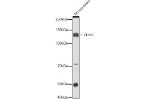 Western blot analysis of extracts of Mouse brain, using CDH5 antibody (ABIN6134029, ABIN6138297, ABIN6138298 and ABIN6216033) at 1:1000 dilution. (Cadherin 5 抗体  (AA 650-750))