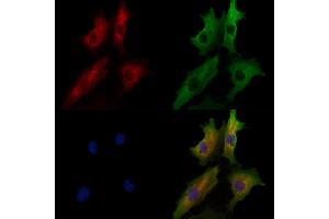 ABIN7094611 and ABIN7098661 staining  cells by IF/ICC. (ANTXR1 抗体  (Internal Region))
