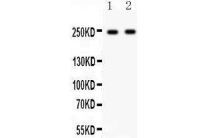 Western Blotting (WB) image for anti-Calcium Channel, Voltage-Dependent, L Type, alpha 1D Subunit (CACNA1D) (AA 1-180) antibody (ABIN3043768) (CACNA1D 抗体  (AA 1-180))
