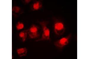 Immunofluorescent analysis of MSK1 staining in HEK293T cells. (MSK1 抗体  (Center))