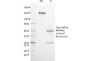 SDS-PAGE Analysis Purified GPN1 Mouse Monoclonal Antibody (GPN1/2350). (GPN1 抗体)