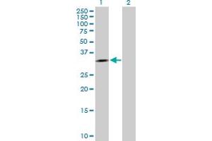 Western Blot analysis of APTX expression in transfected 293T cell line by APTX MaxPab polyclonal antibody. (Aprataxin 抗体  (AA 1-254))