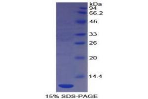 SDS-PAGE analysis of Human PECAM1 Protein. (CD31 蛋白)
