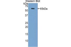 Western blot analysis of the recombinant protein. (PPL 抗体  (AA 1439-1716))