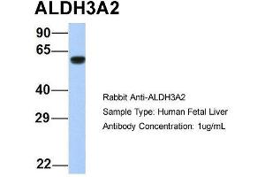Host:  Rabbit  Target Name:  ALDH3A2  Sample Type:  Human Fetal Liver  Antibody Dilution:  1. (ALDH3A2 抗体  (Middle Region))