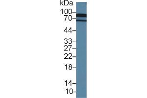 Western Blot; Sample: Porcine Cerebrum lysate; Primary Ab: 1. (Cadherin 13 抗体  (AA 179-366))