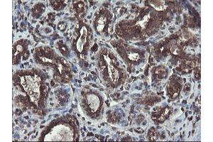 Immunohistochemical staining of paraffin-embedded Human breast tissue using anti-ACBD3 mouse monoclonal antibody. (ACBD3 抗体)
