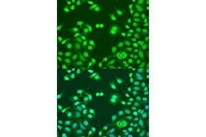 Immunofluorescence analysis of U2OS cells using NUM antibody (ABIN1681136, ABIN3015188, ABIN3015190 and ABIN6213875) at dilution of 1:100. (NUMA1 抗体  (AA 1-309))