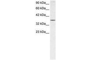 Image no. 1 for anti-Homeobox A7 (HOXA7) (N-Term) antibody (ABIN6735815) (HOXA7 抗体  (N-Term))
