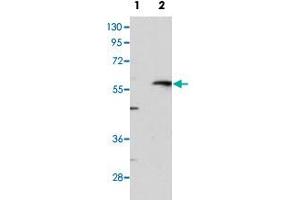 Western blot analysis of MMP13 (arrow) using MMP13 polyclonal antibody . (MMP13 抗体  (C-Term))