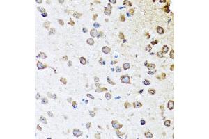 Immunohistochemistry of paraffin-embedded mouse brain using SERPINA10 antibody at dilution of 1:100 (40x lens). (SERPINA10 抗体)