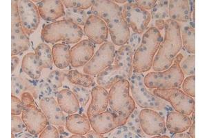 Immunohistochemistry (IHC) image for anti-Basigin (Ok Blood Group) (BSG) (AA 59-321) antibody (ABIN7440611)