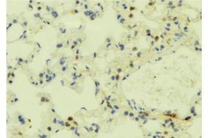 ABIN6273849 at 1/100 staining Mouse lung tissue by IHC-P. (FPR2 抗体  (C-Term))